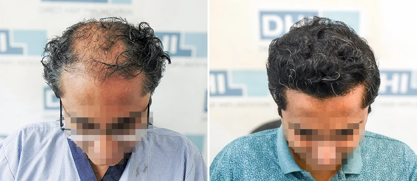 Result - 9 Months, Age 47