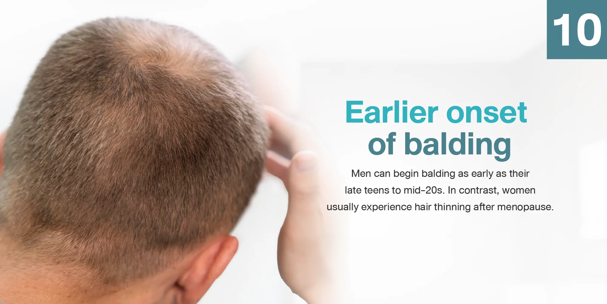 Earlier onset of balding