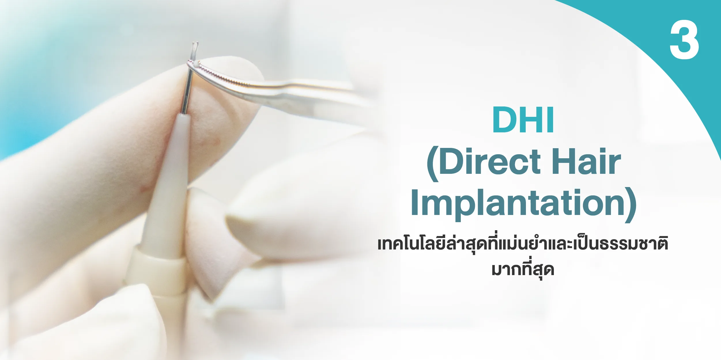 DHI (Direct Hair Implantation)