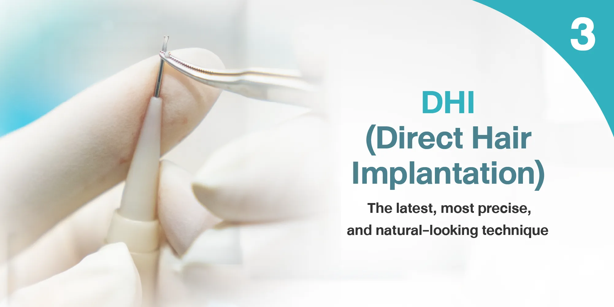 DHI (Direct Hair Implantation)