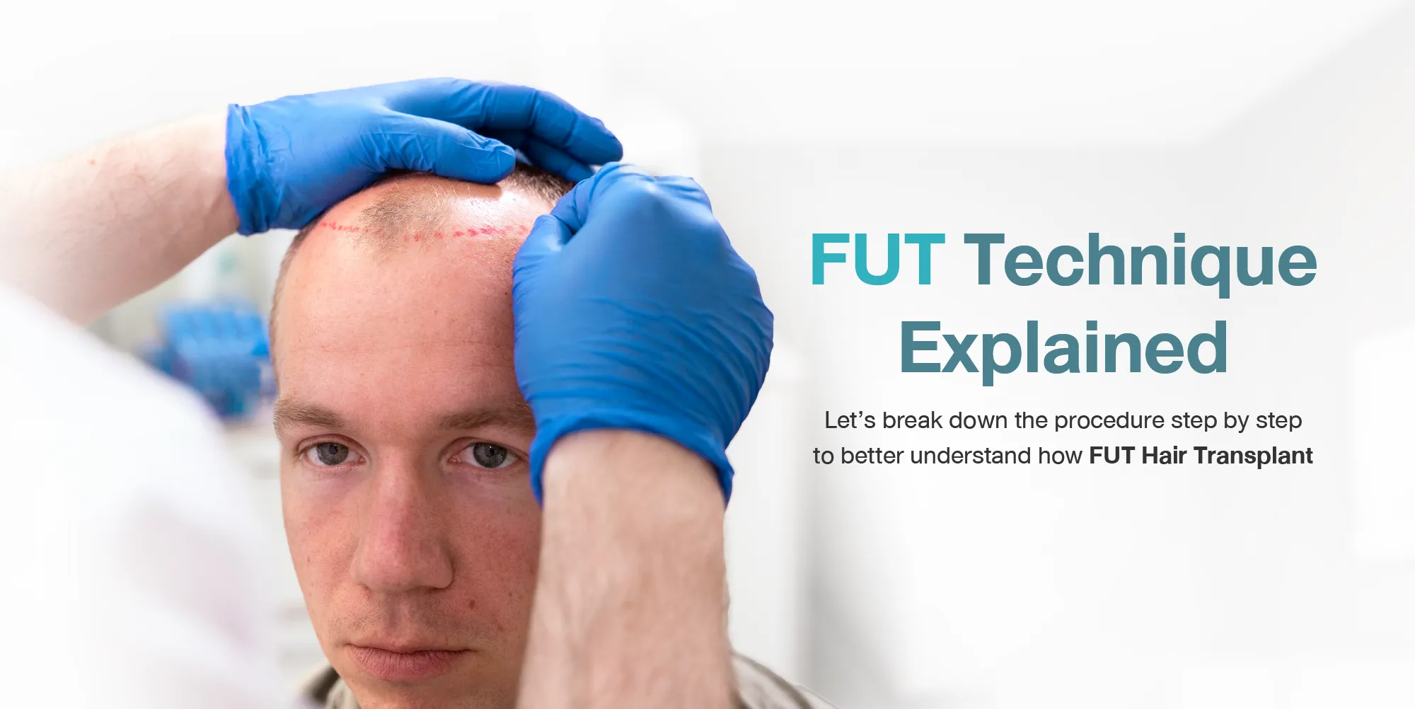FUT Technique Explained