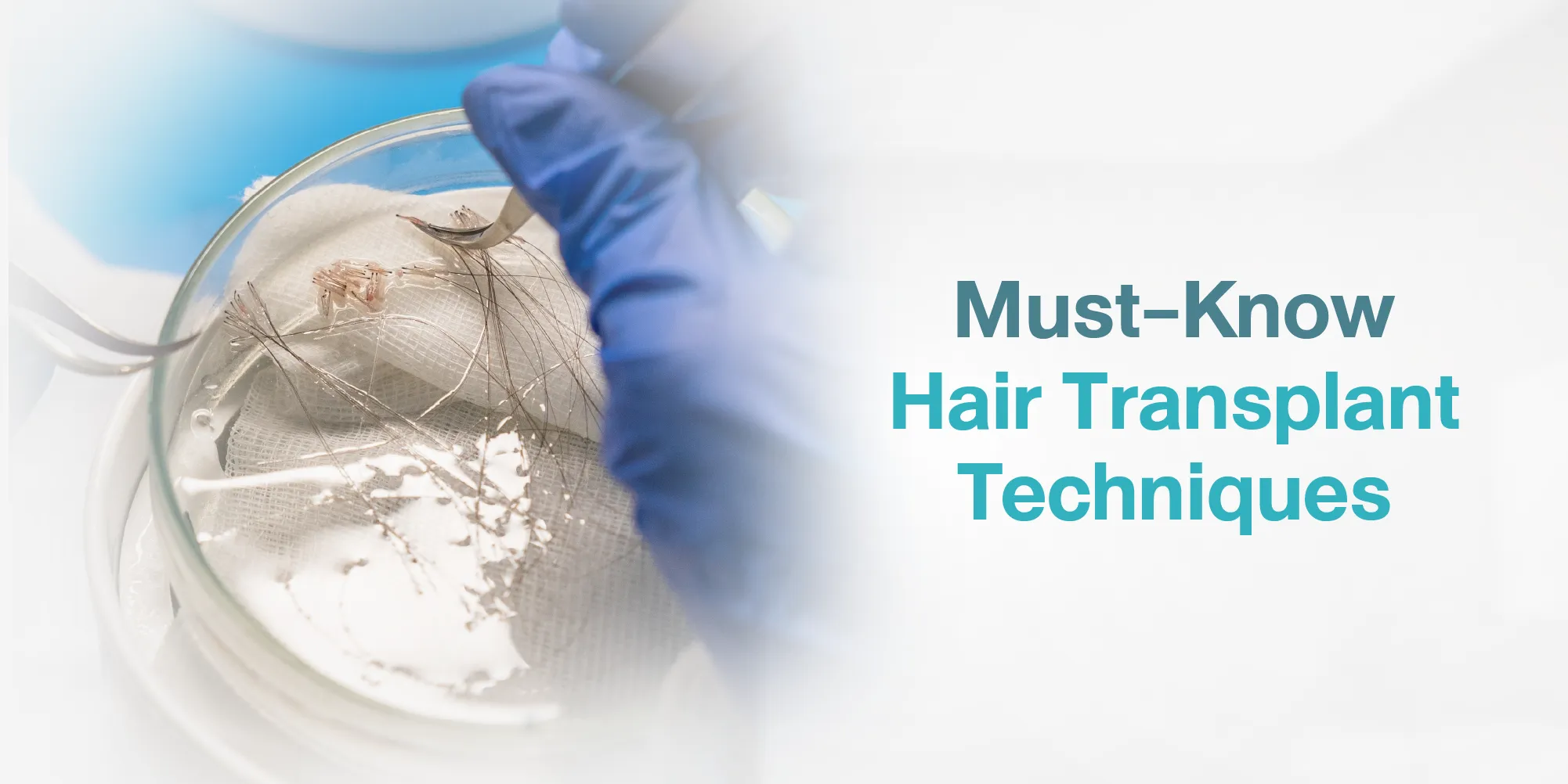 Must-Know Hair Transplant Techniques