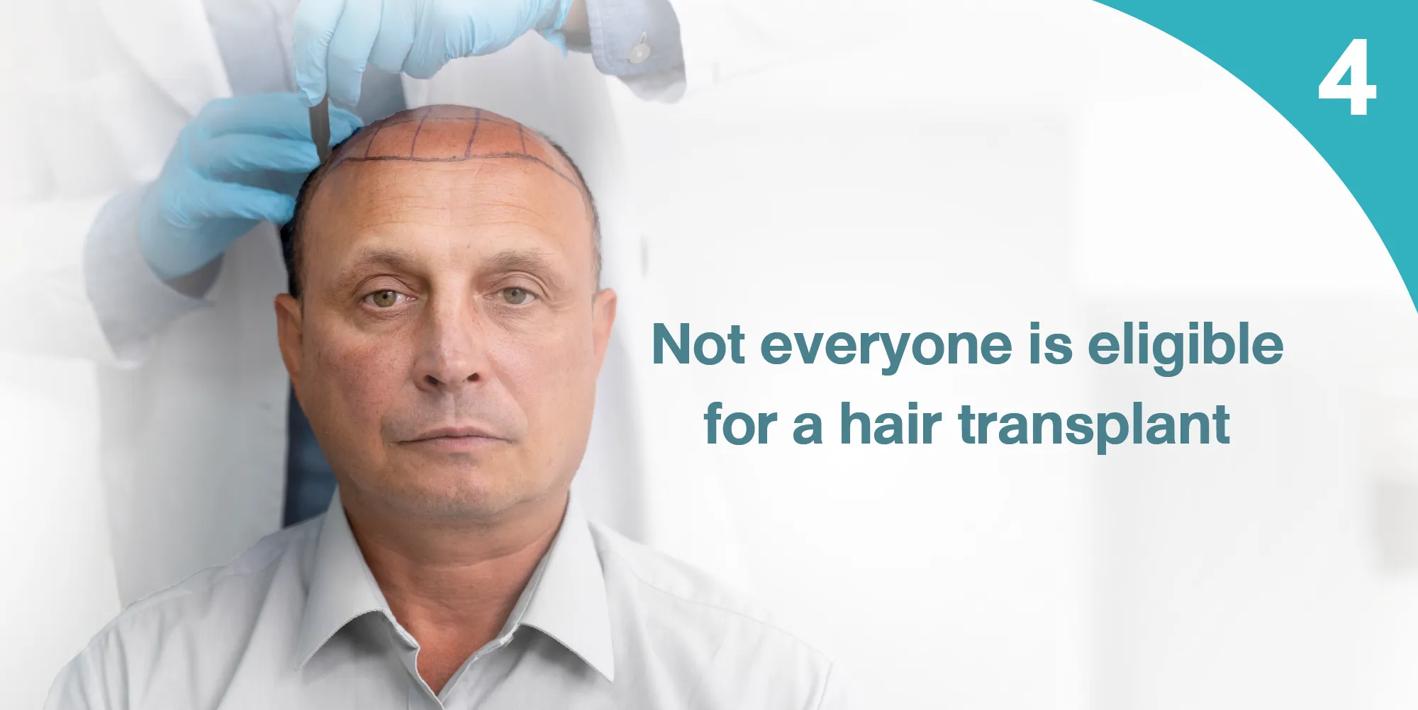 Not everyone is immediately eligible for a transplant