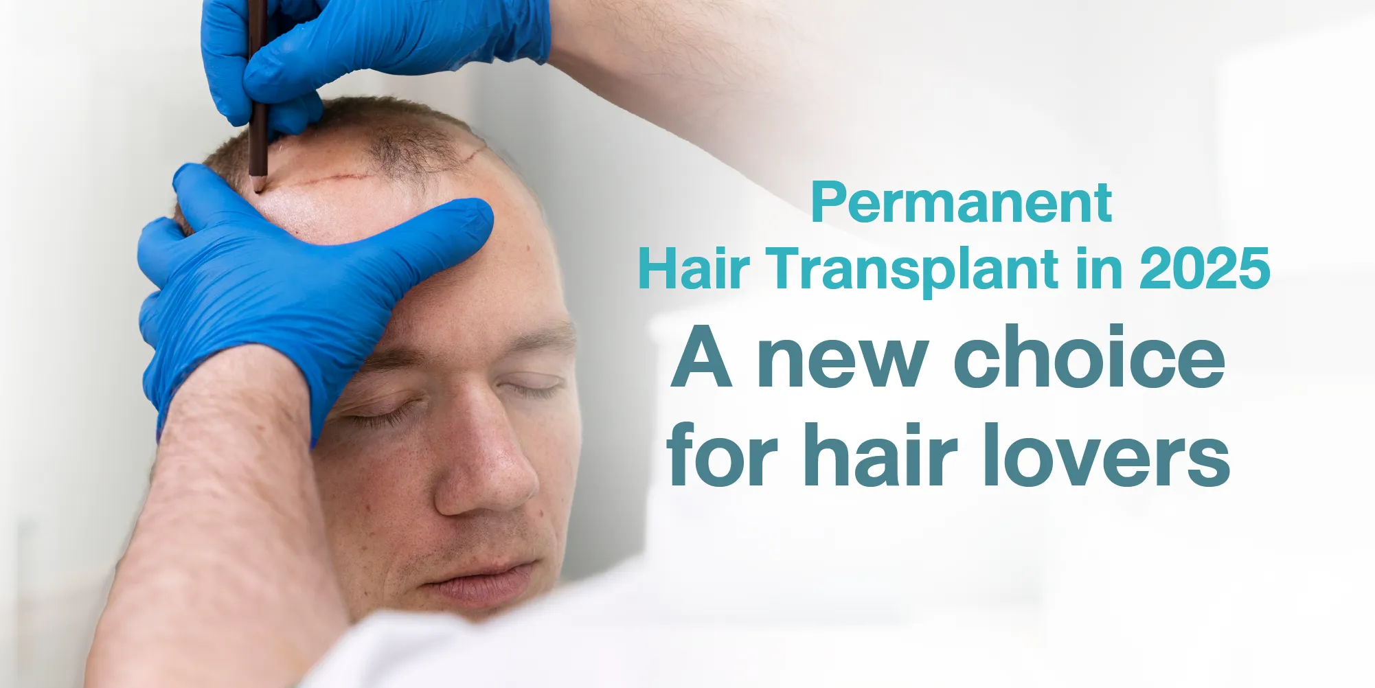 Permanent Hair Transplant 2025