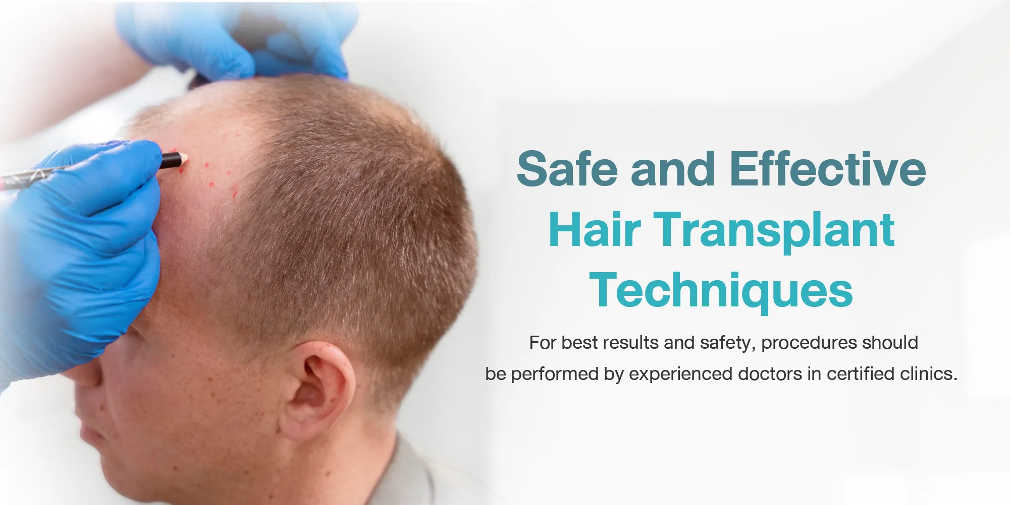 What Makes a Hair Transplant Effective and Safe