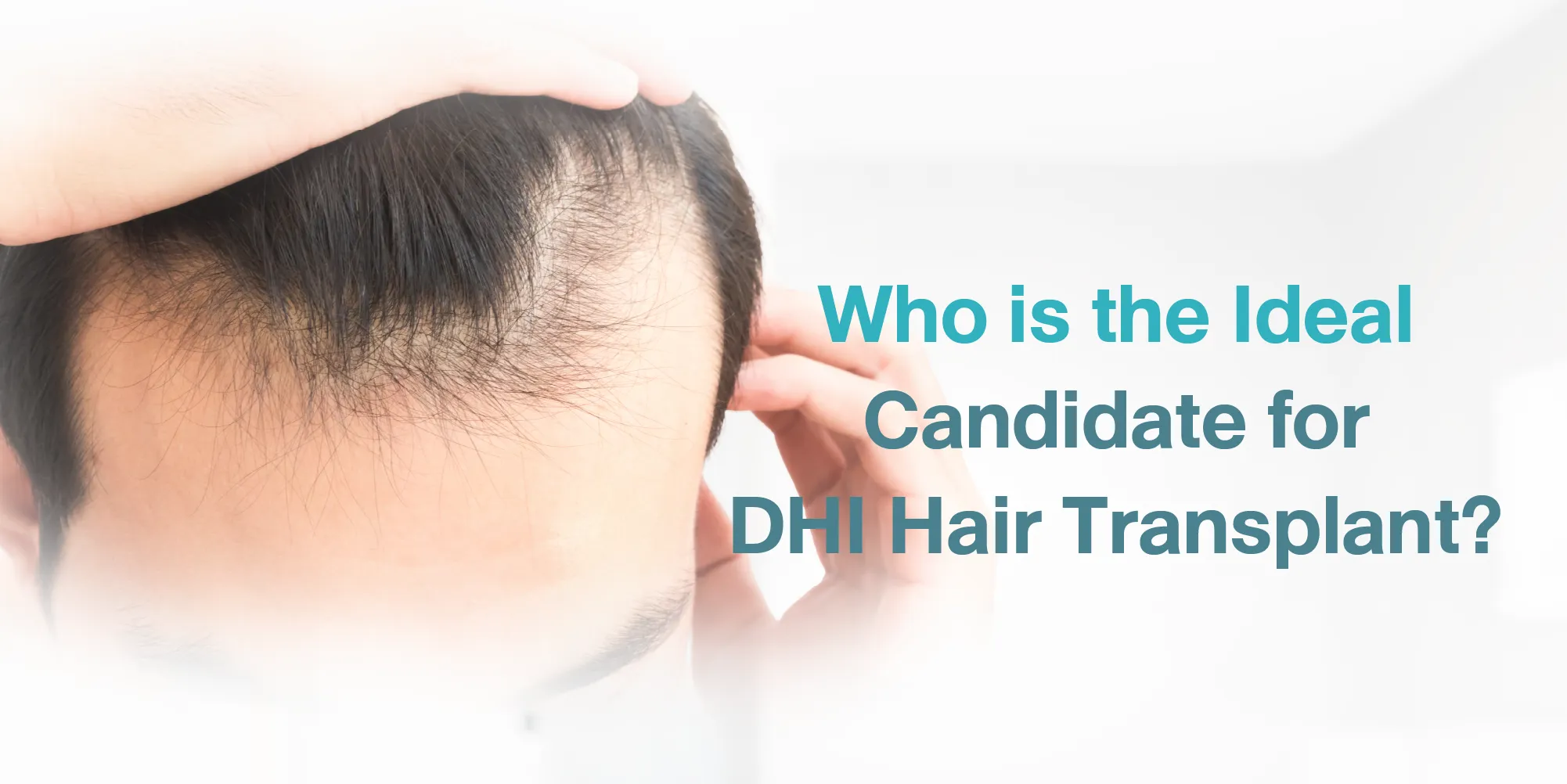Who is the Ideal Candidate for DHI Hair Transplant