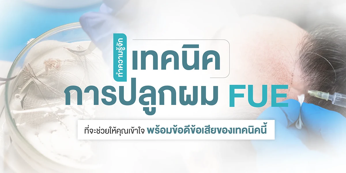 การปลูกผม FUE