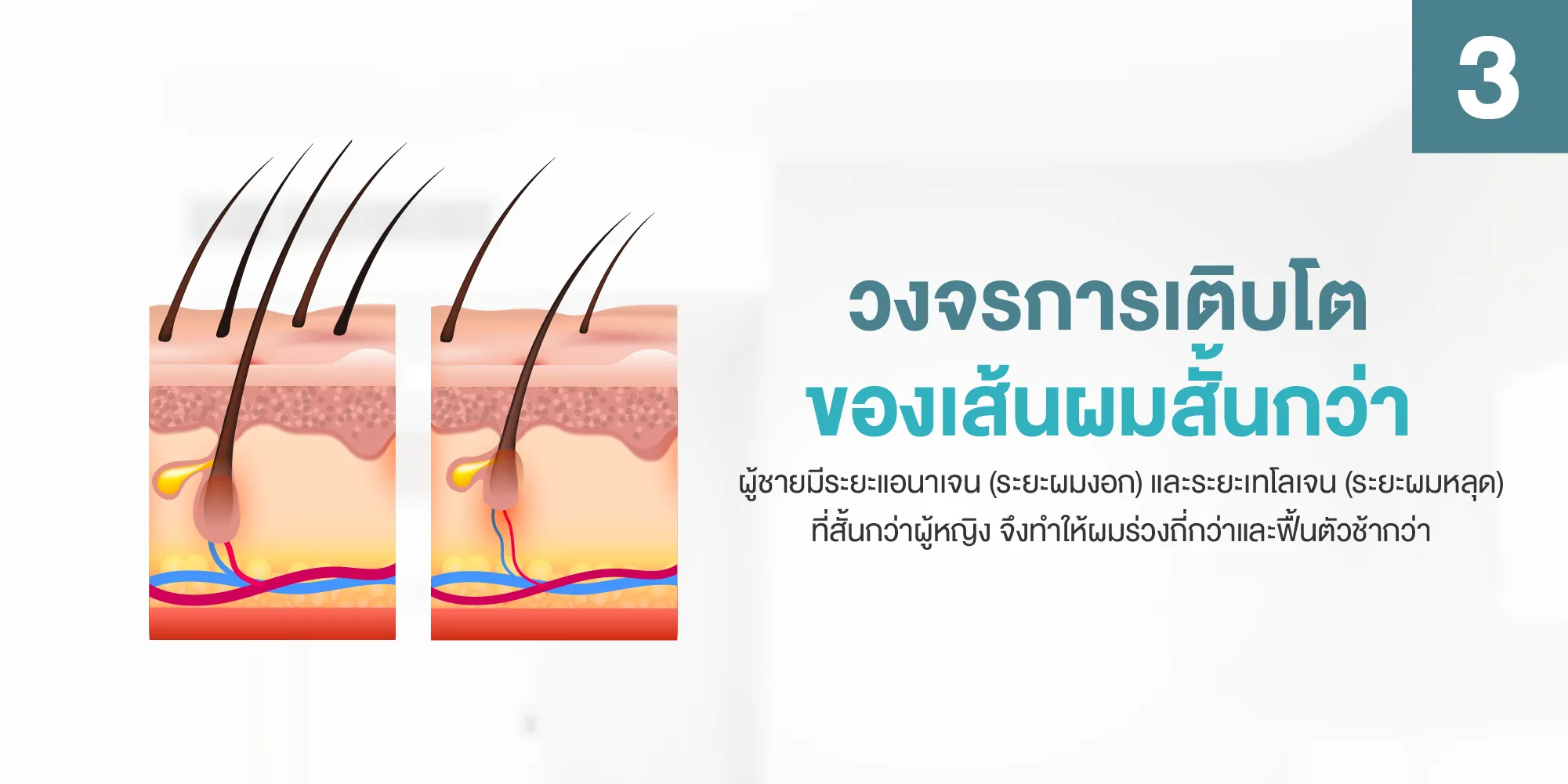วงจรการเติบโตของเส้นผมสั้นกว่า