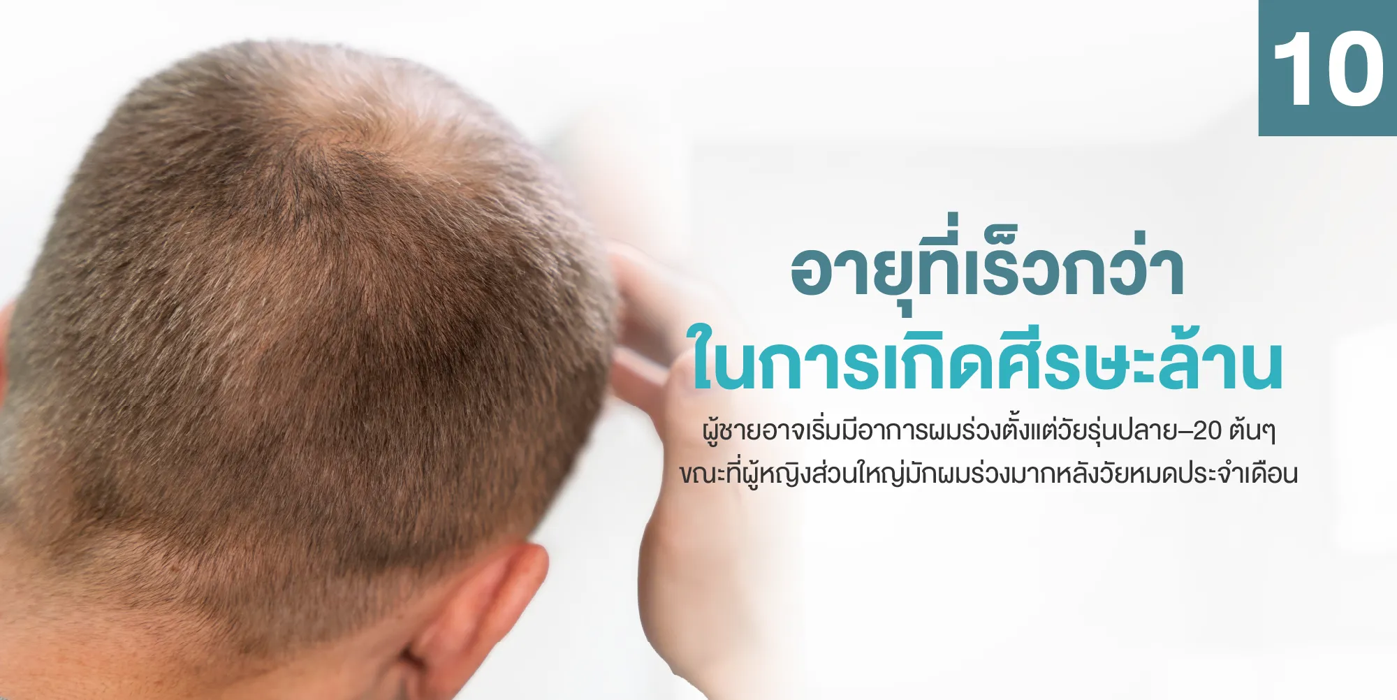 อายุที่เร็วกว่าในการเกิดศีรษะล้าน