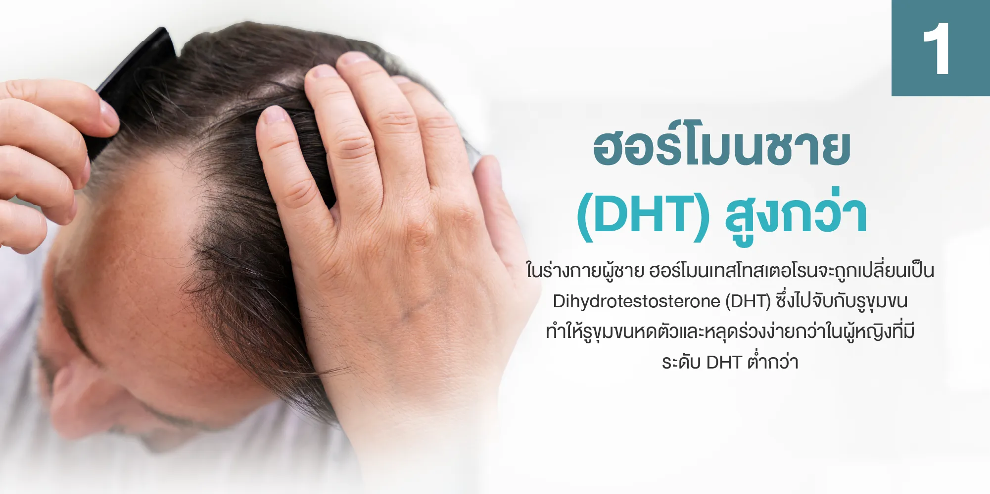 ฮอร์โมนชาย (DHT) สูงกว่า