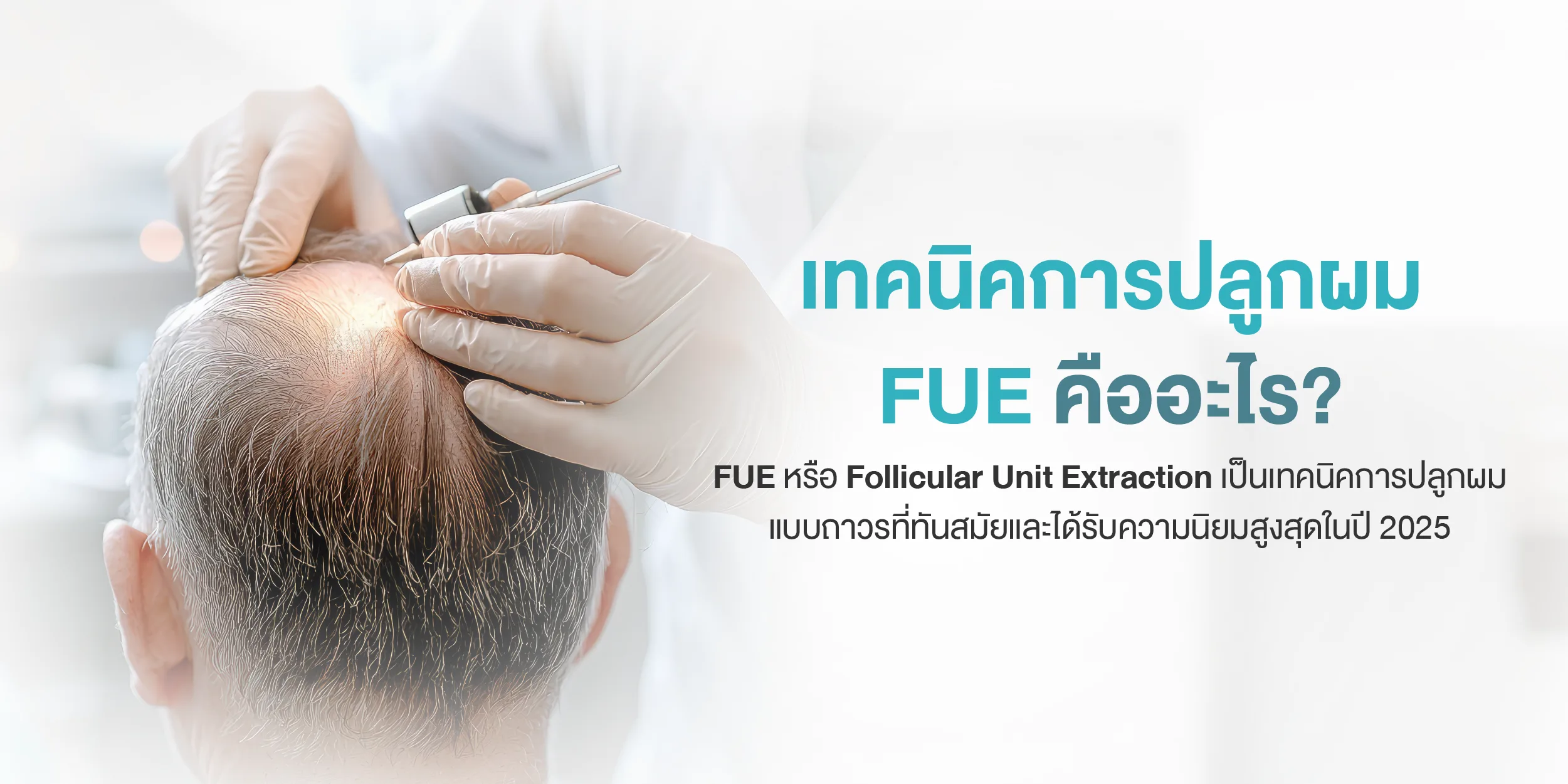 เทคนิคการปลูกผม FUE คืออะไร