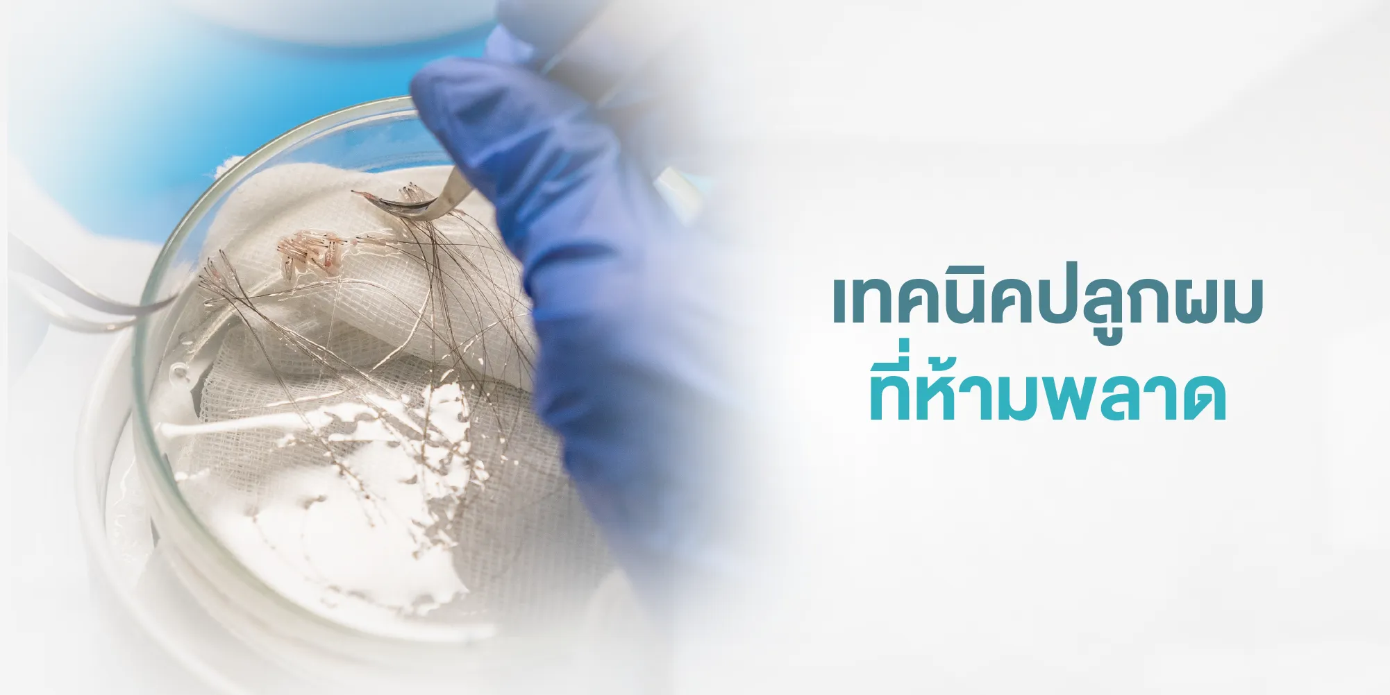 เทคนิคปลูกผมที่ห้ามพลาด