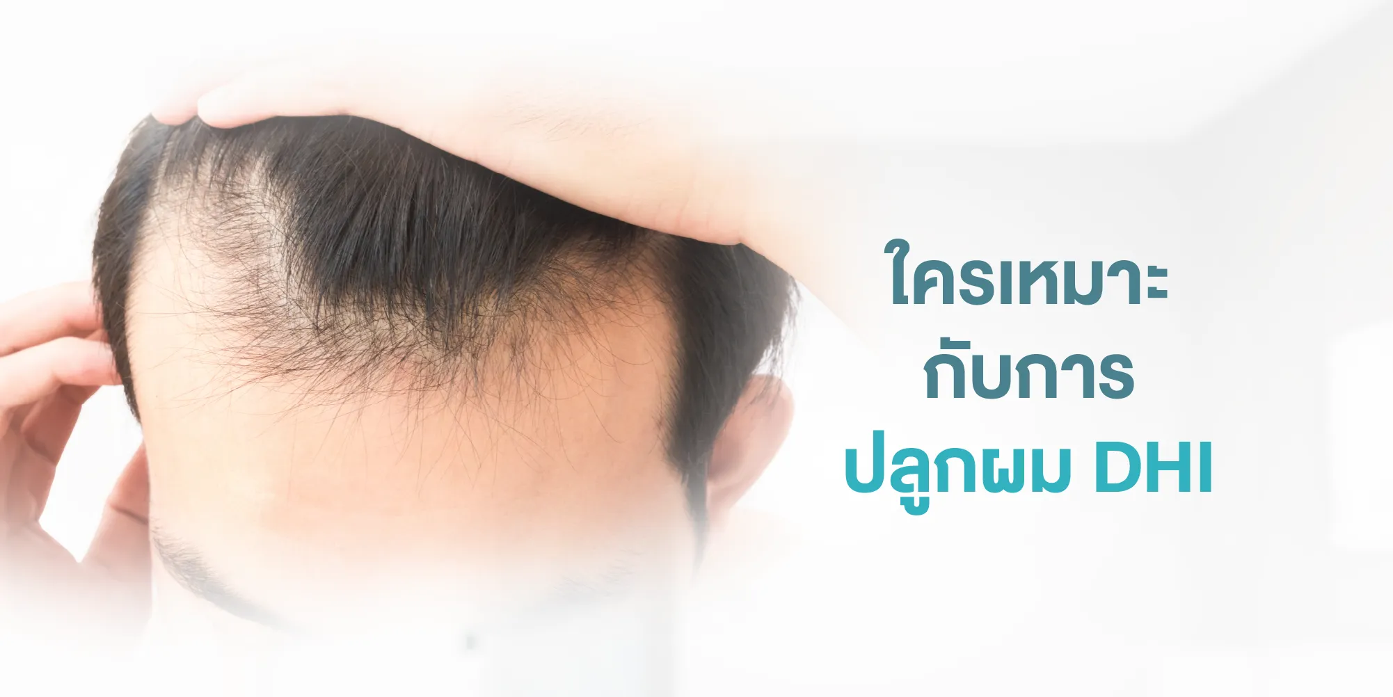 ใครเหมาะกับการปลูกผม DHI