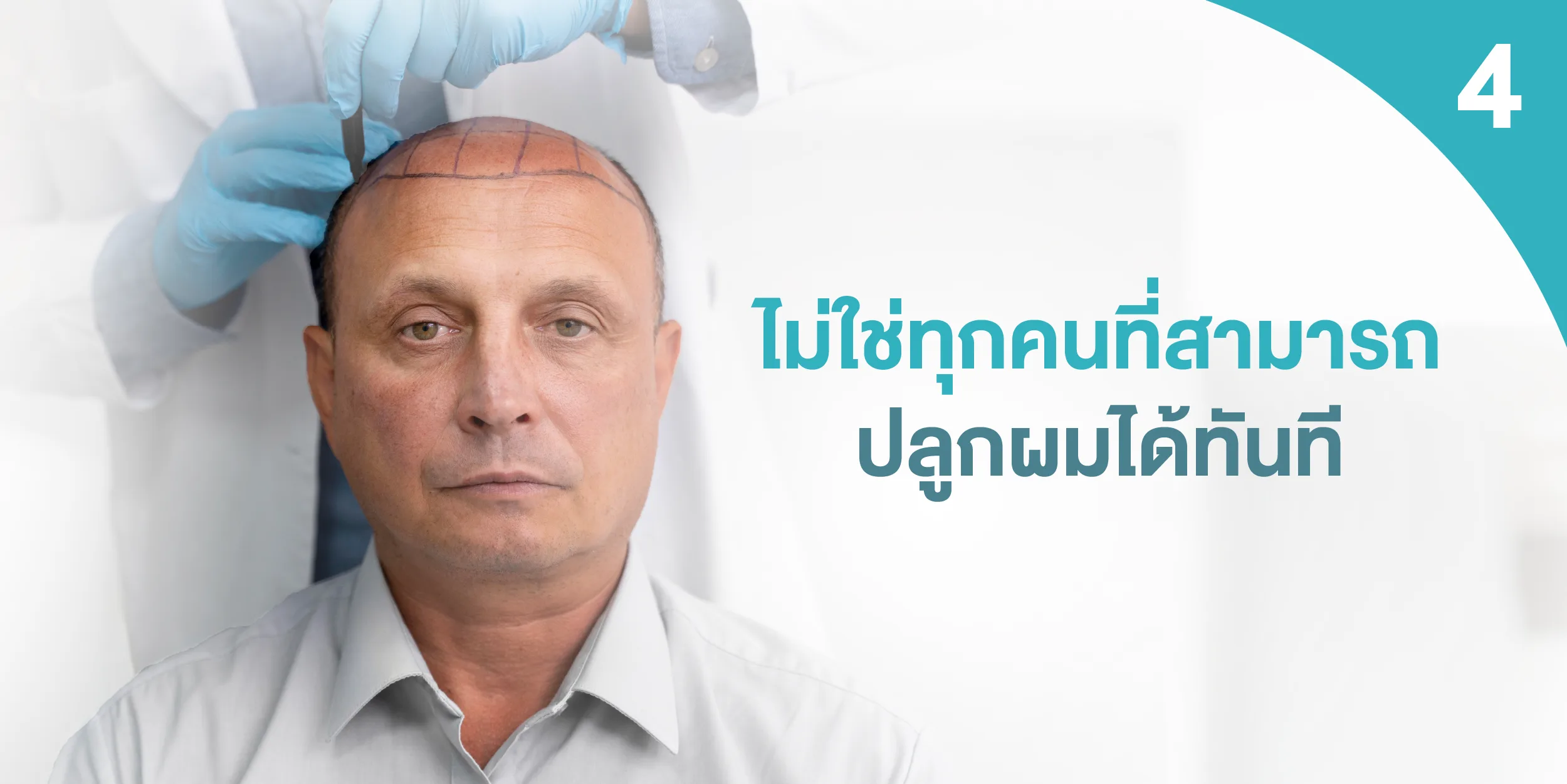 ไม่ใช่ทุกคนที่สามารถปลูกผมได้ทันที