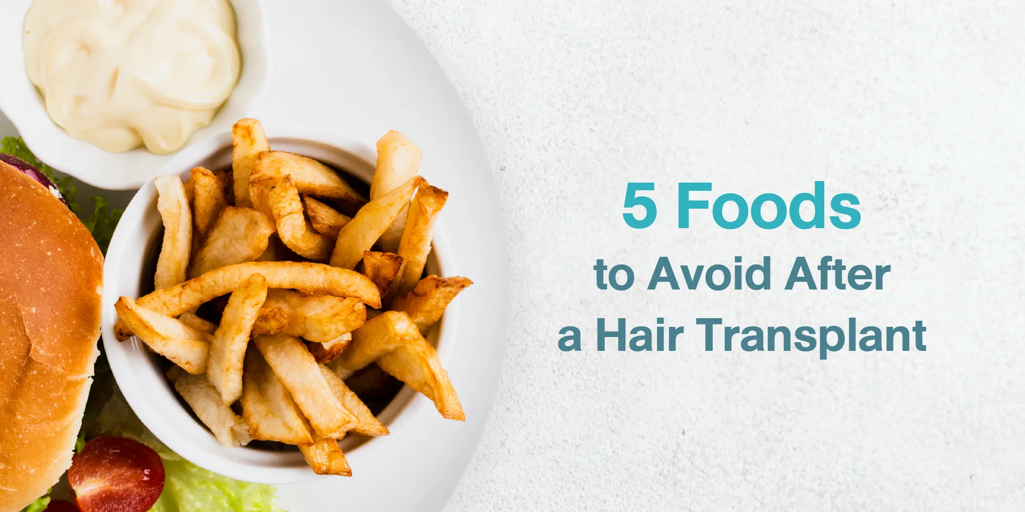 5 Foods to Avoid After a Hair Transplant