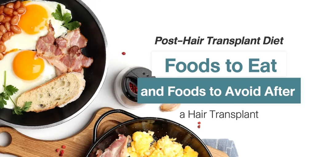 Post-Hair Transplant Diet Foods to Eat and Foods to Avoid After a Hair Transplant