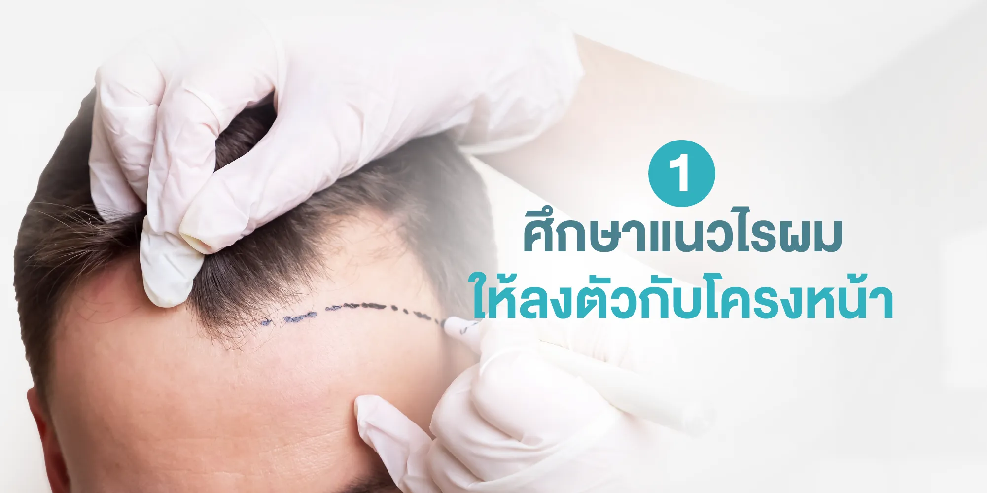 ศึกษาแนวไรผม ให้ลงตัวกับโครงหน้า