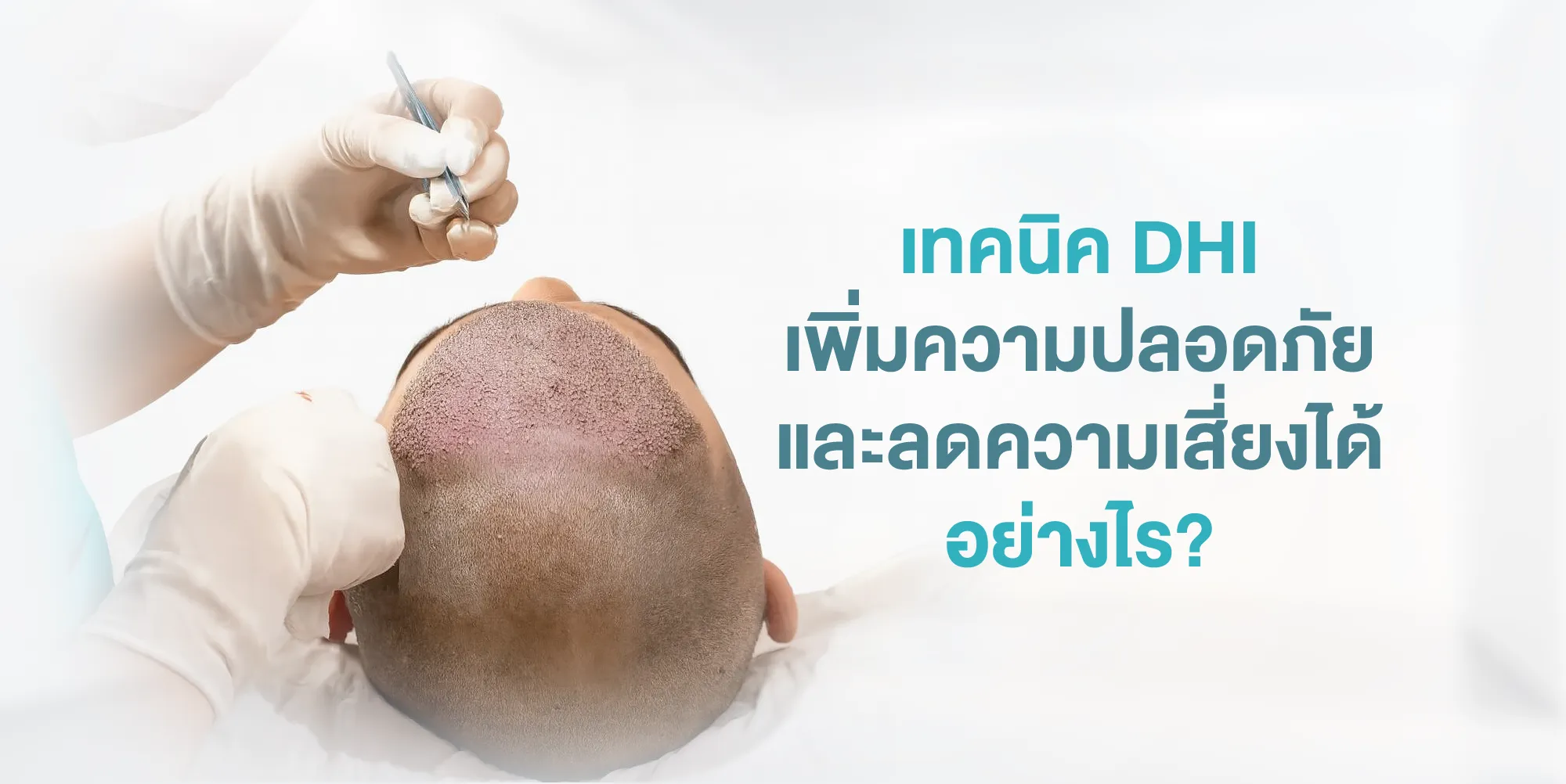 เทคนิค DHI เพิ่มความปลอดภัยและลดความเสี่ยงได้อย่างไร