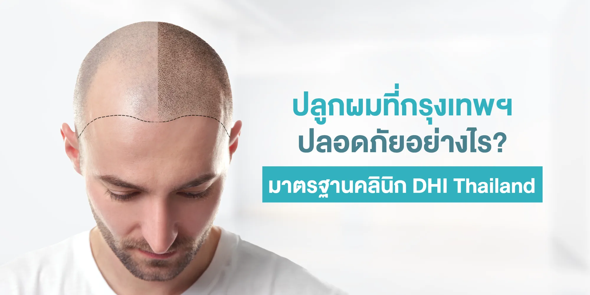 ปลูกผมที่กรุงเทพฯ ปลอดภัยอย่างไร