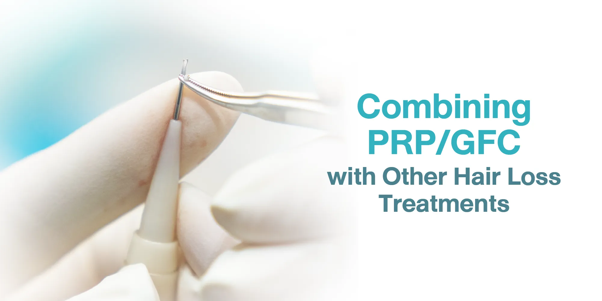 Combining PRPGFC with Other Hair Loss Treatments