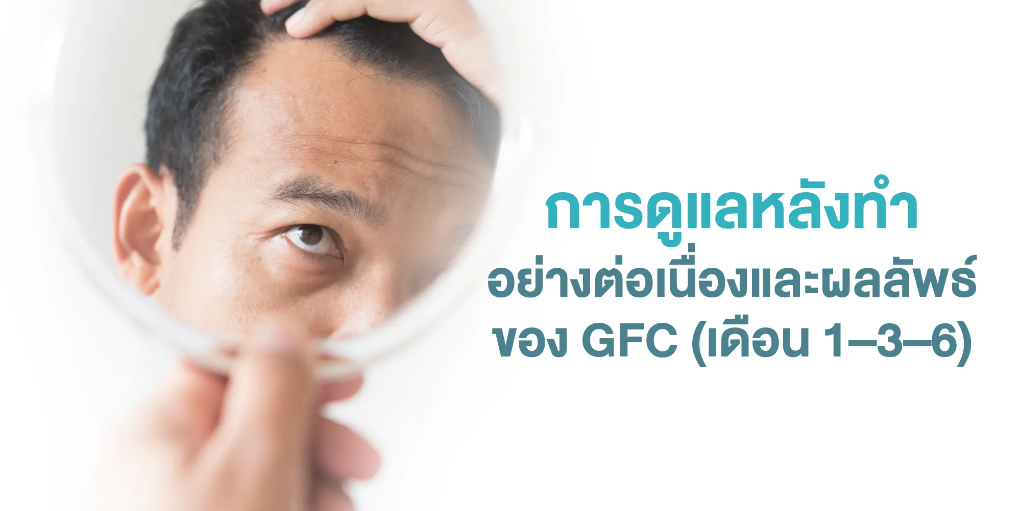 การดูแลหลังทำอย่างต่อเนื่องและผลลัพธ์ของ GFC (เดือน 1–3–6)