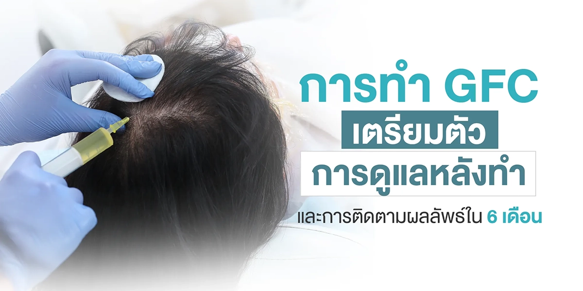 การทำ GFC เตรียมตัว, การดูแลหลังทำ, และการติดตามผลลัพธ์ใน 6 เดือน