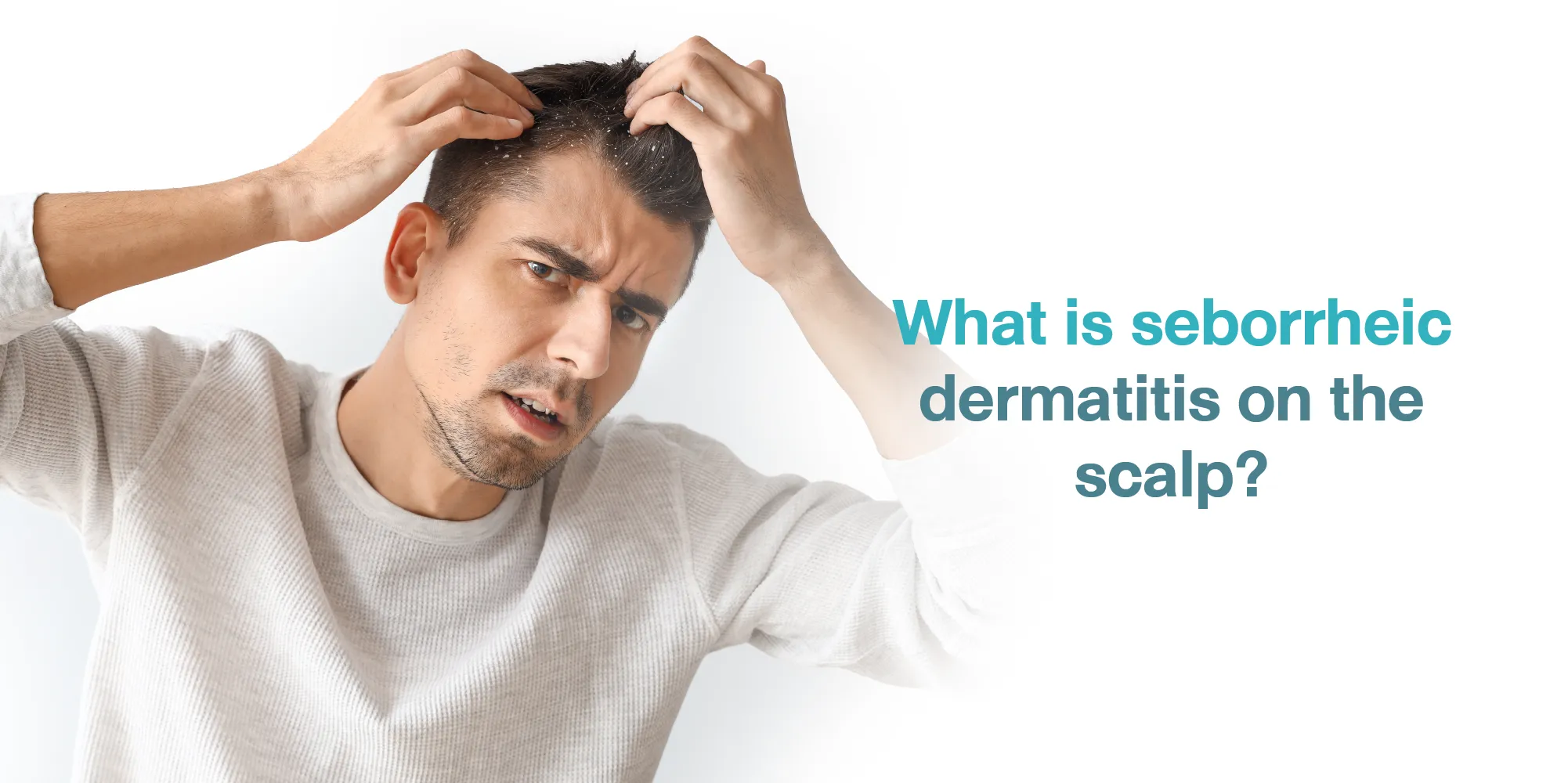 What is causes seborrheic dermatitis on the scalp