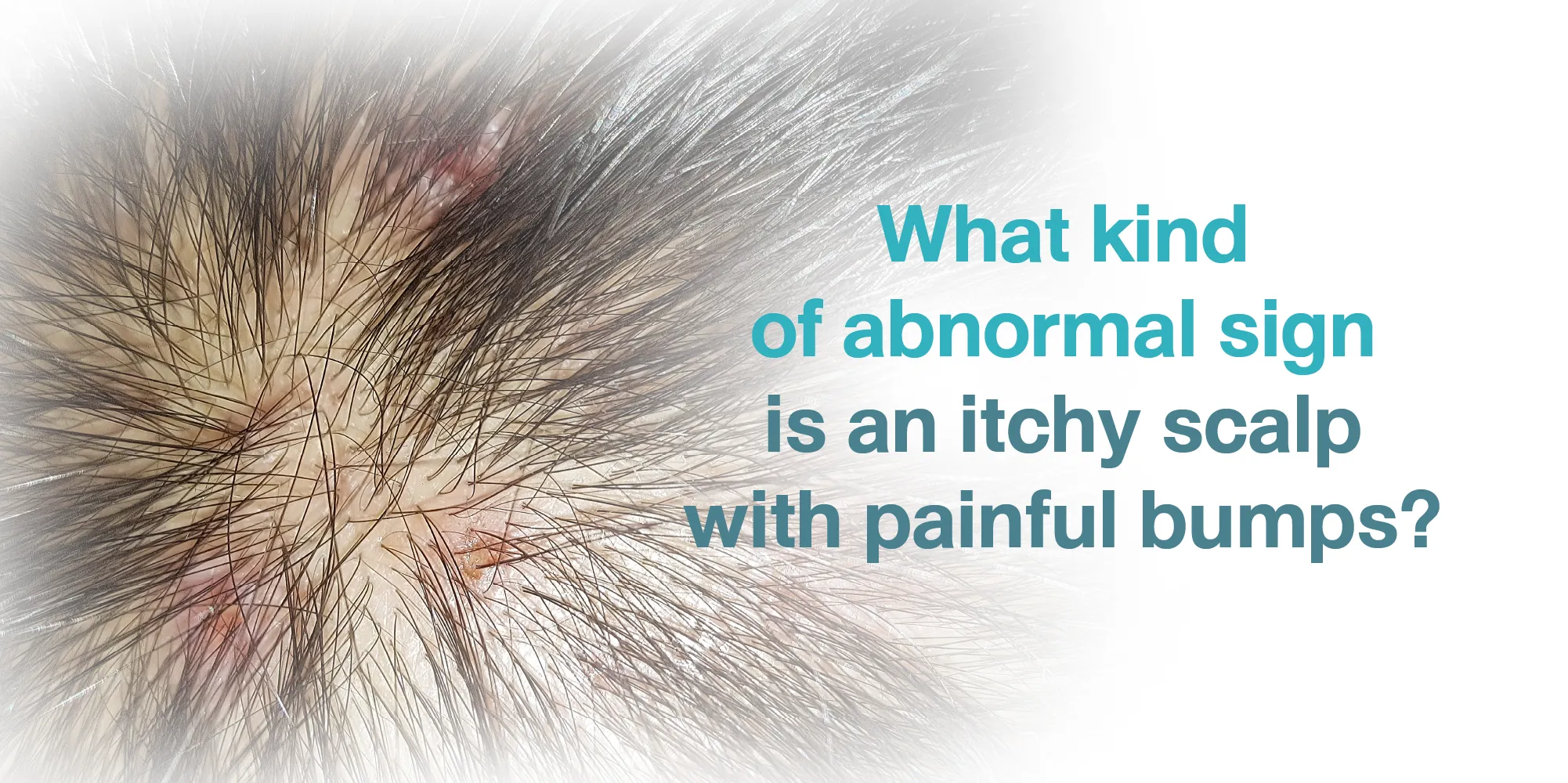 What kind of abnormal sign is an itchy scalp with painful bumps