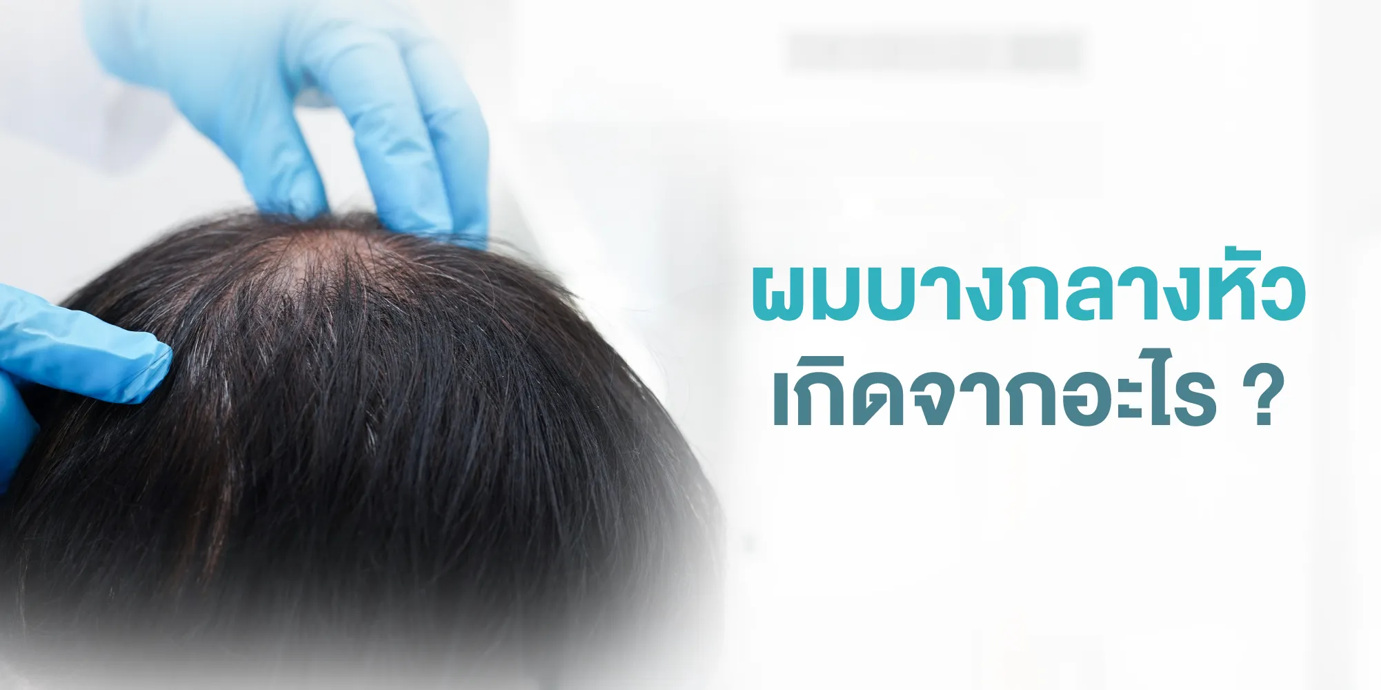ผมบางกลางหัว เกิดจากอะไร