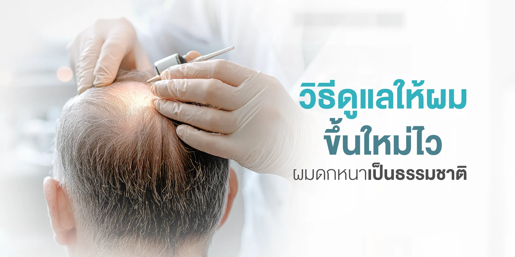 วิธีดูแลให้ผมขึ้นใหม่ไว ผมดกหนาเป็นธรรมชาติ