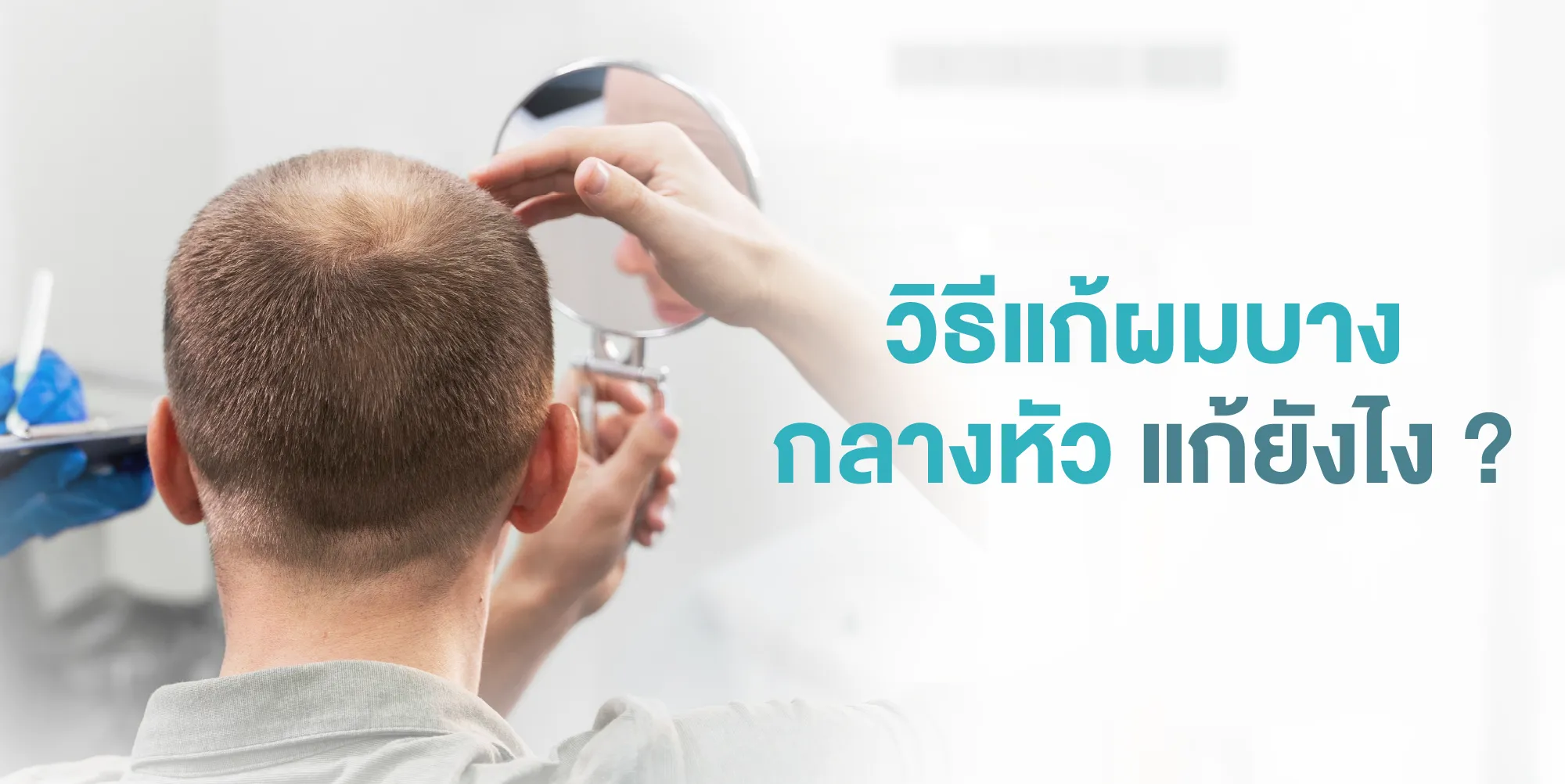 วิธีแก้ผมบางกลางหัว แก้ยังไง