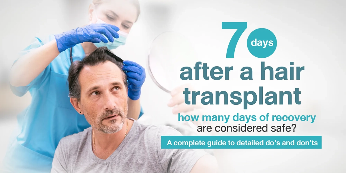 7 days after a hair transplant how many days of recovery are considered safe A complete guide to detailed do’s and don’ts