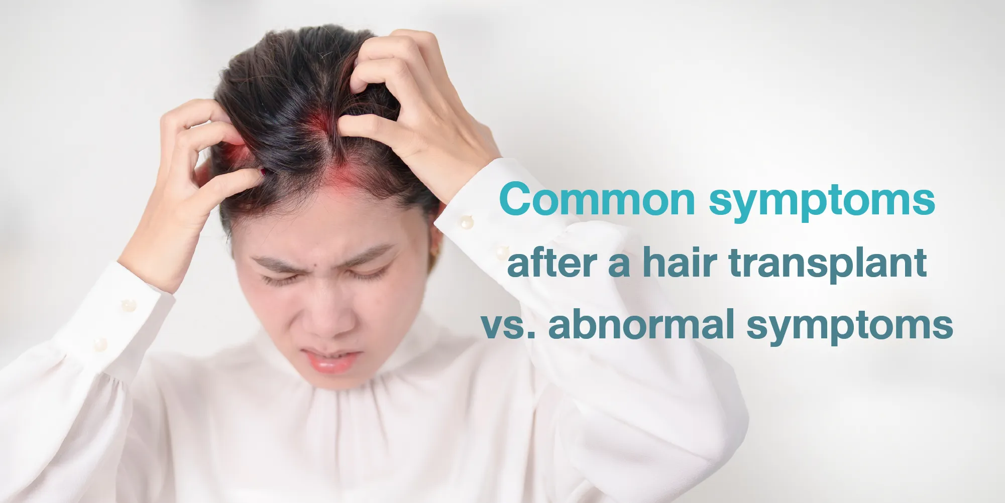 Common symptoms after a hair transplant vs. abnormal symptoms