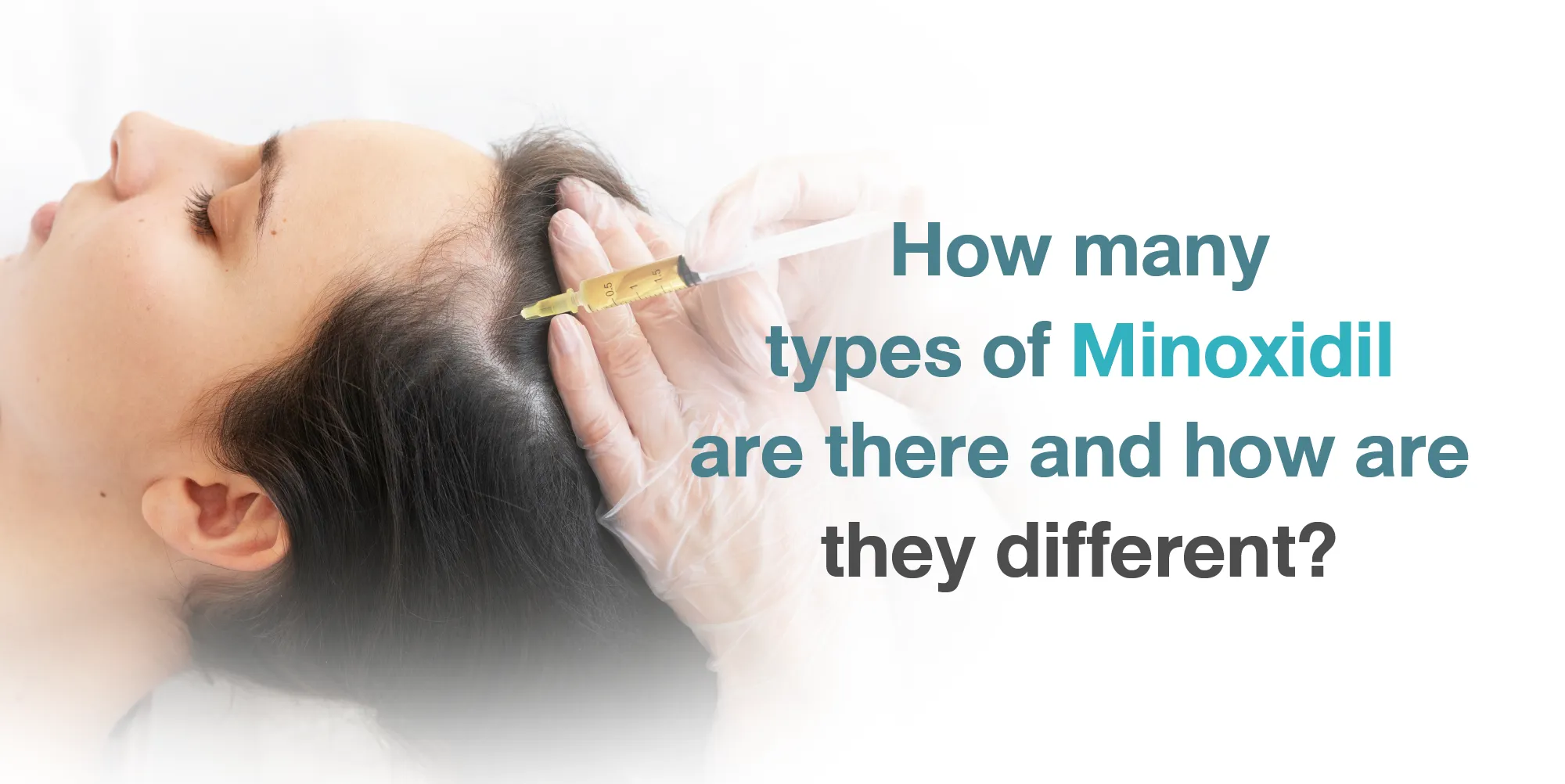How many types of Minoxidil are there and how are they different