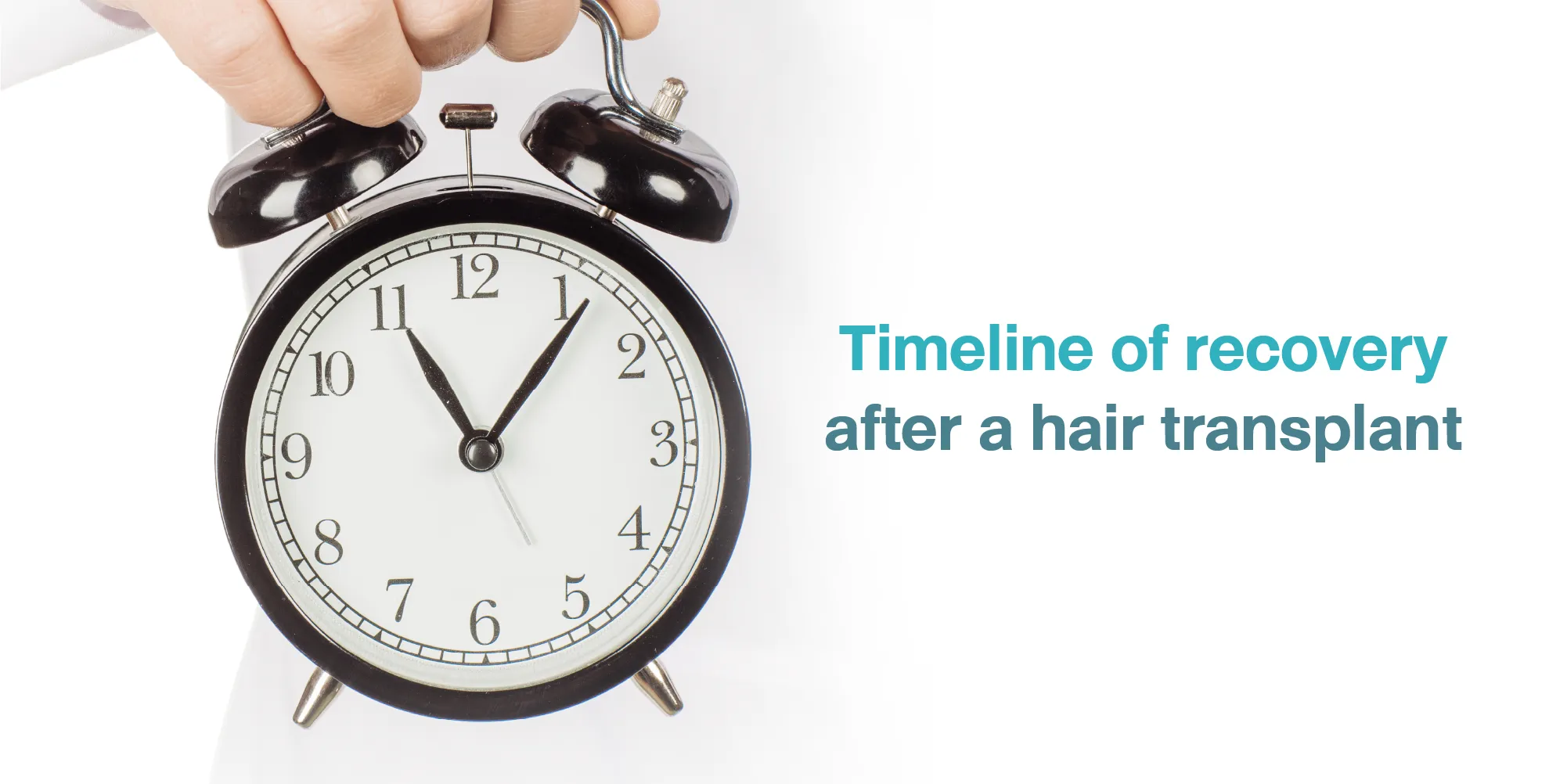 Timeline of recovery after a hair transplant