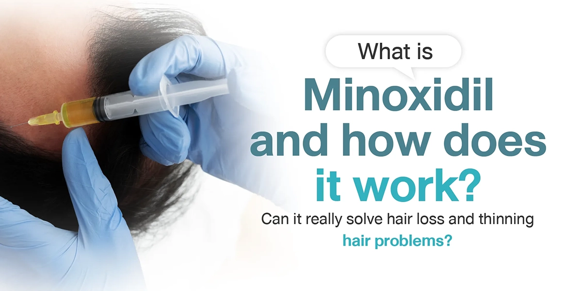 What is Minoxidil and how does it work Can it really solve hair loss and thinning hair problems
