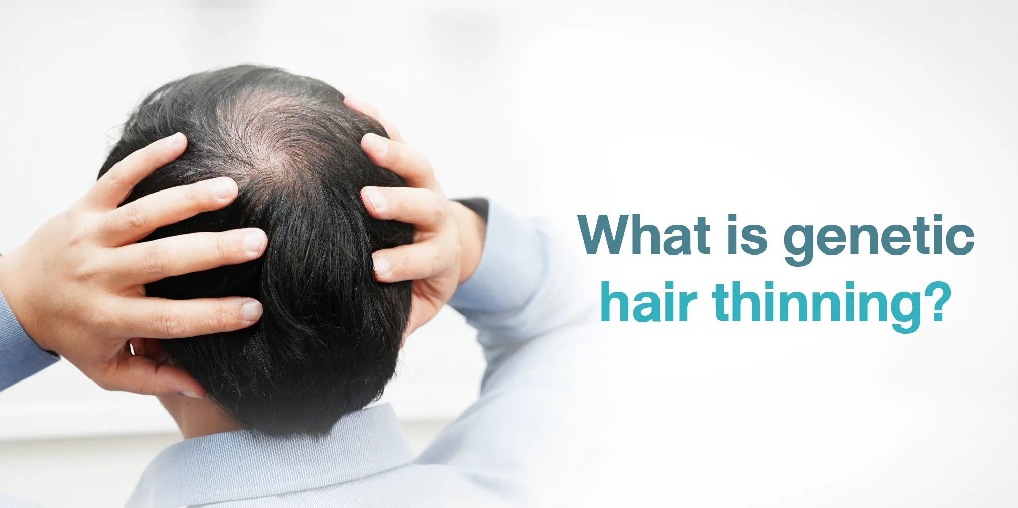 What is genetic hair thinning