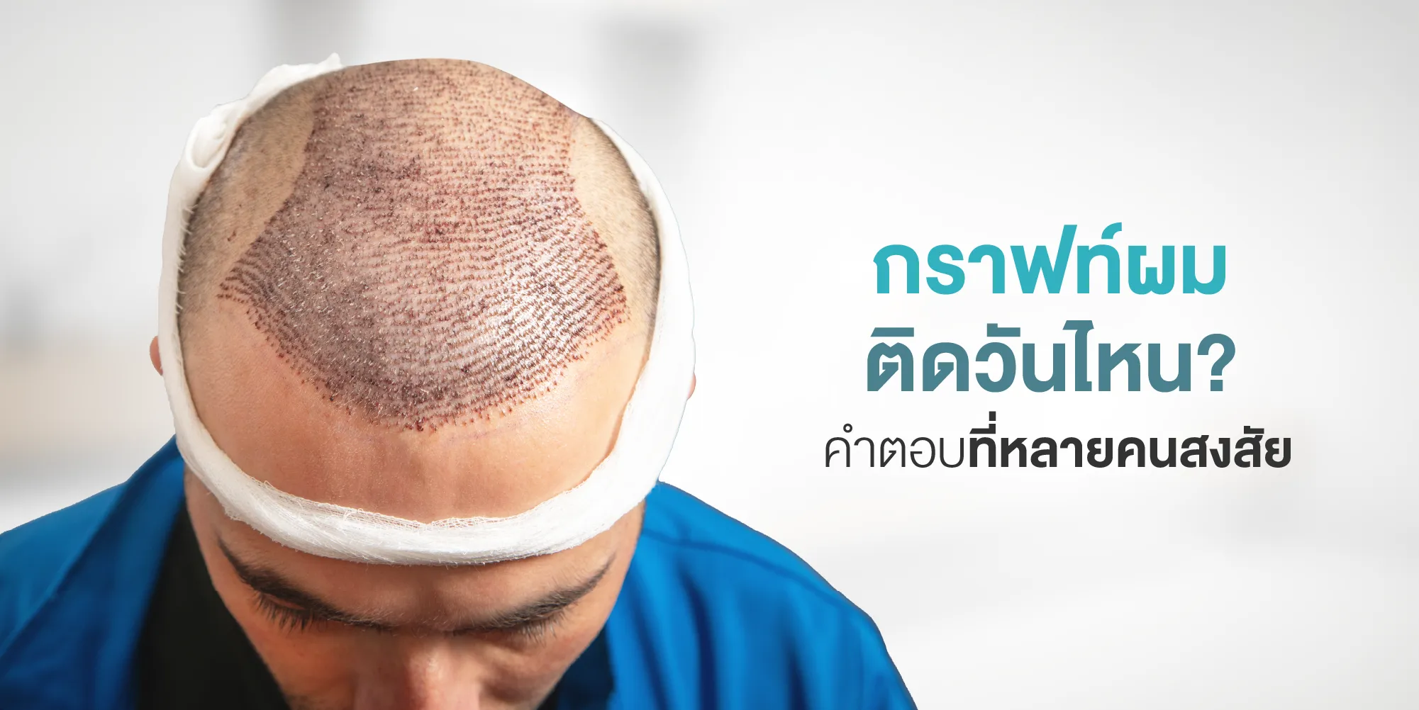 กราฟท์ผมติดวันไหน คำตอบที่หลายคนสงสัย
