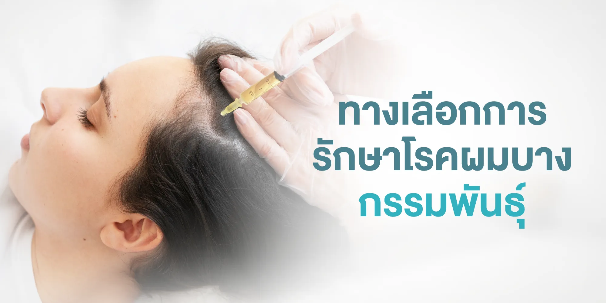 ทางเลือกการรักษาโรคผมบางกรรมพันธุ์