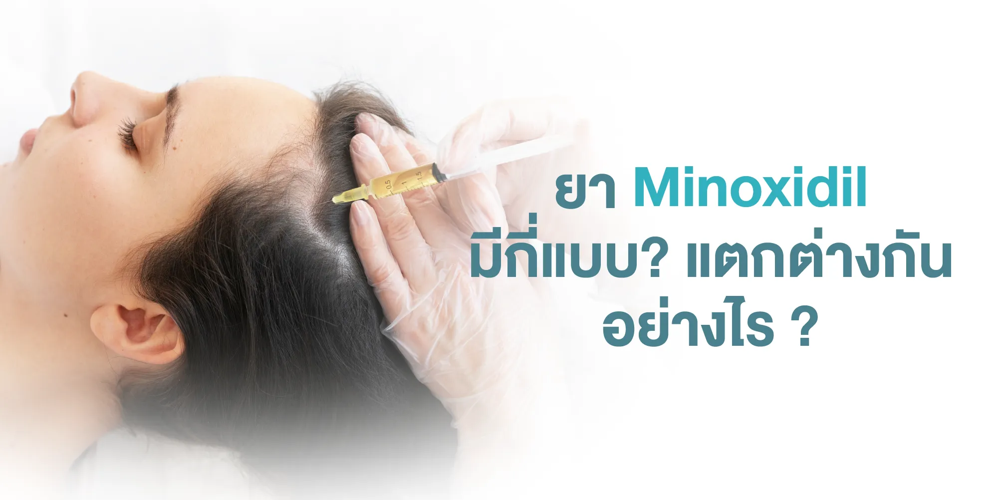 ยา Minoxidil มีกี่แบบ แตกต่างกันอย่างไร