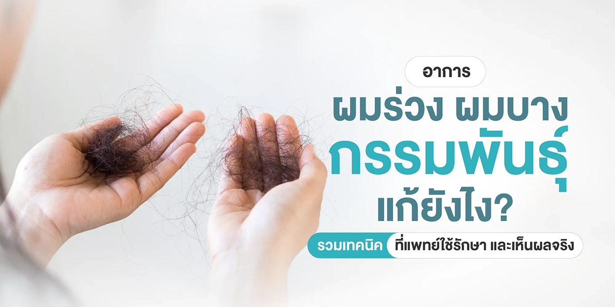 อาการผมร่วง ผมบางกรรมพันธุ์แก้ยังไง
