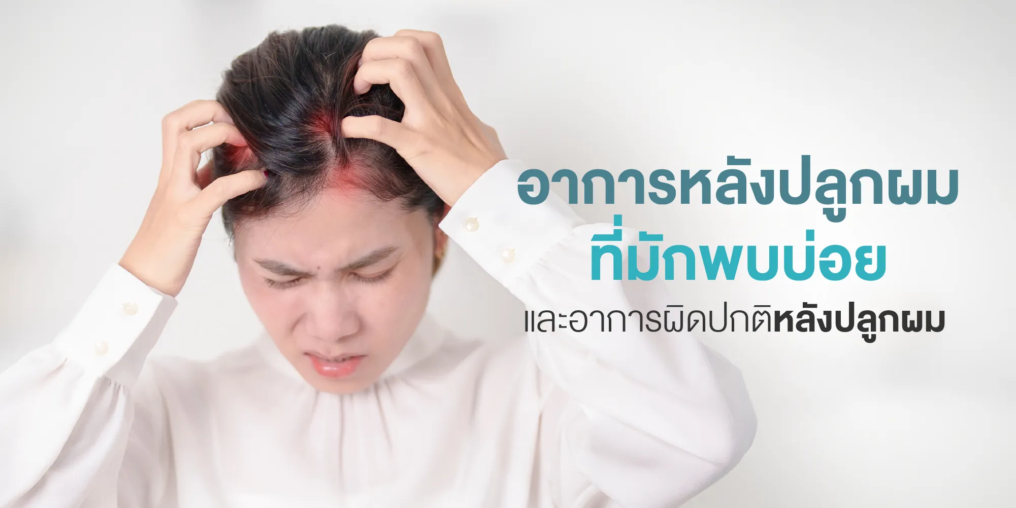 อาการหลังปลูกผมที่มักพบบ่อย และอาการผิดปกติหลังปลูกผม