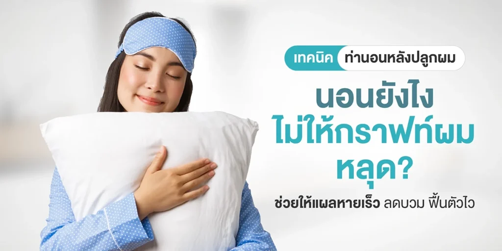 เทคนิคท่านอนหลังปลูกผม นอนยังไงไม่ให้กราฟท์ผมหลุด ช่วยให้แผลหายเร็ว ลดบวม ฟื้นตัวไว