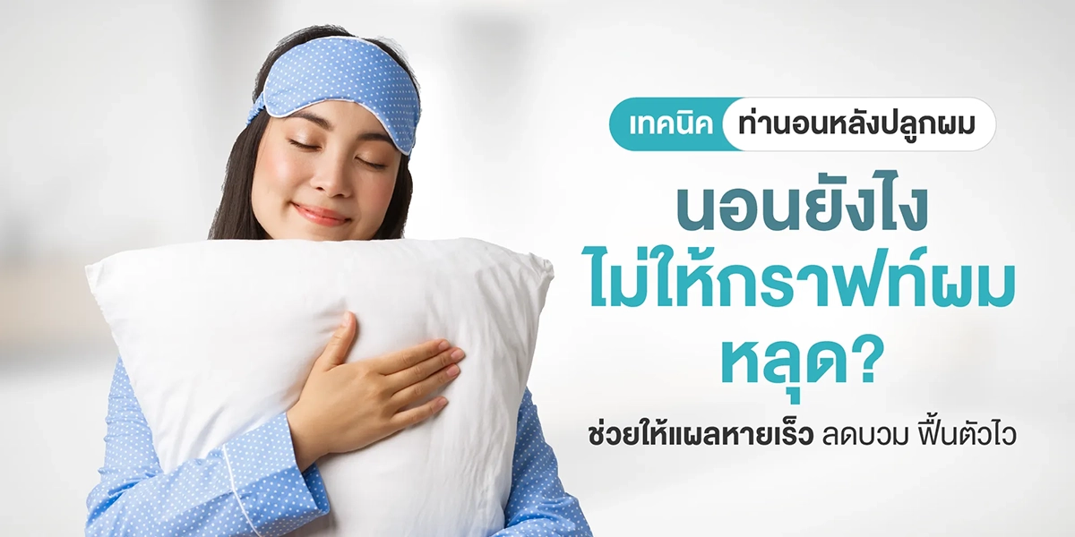เทคนิคท่านอนหลังปลูกผม นอนยังไงไม่ให้กราฟท์ผมหลุด ช่วยให้แผลหายเร็ว ลดบวม ฟื้นตัวไว