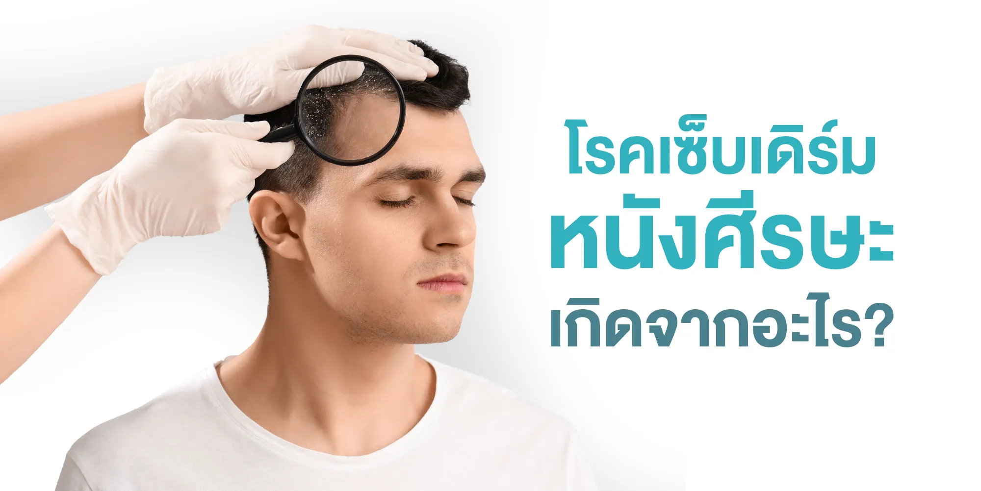 โรคเซ็บเดิร์ม หนังศีรษะ เกิดจากอะไร