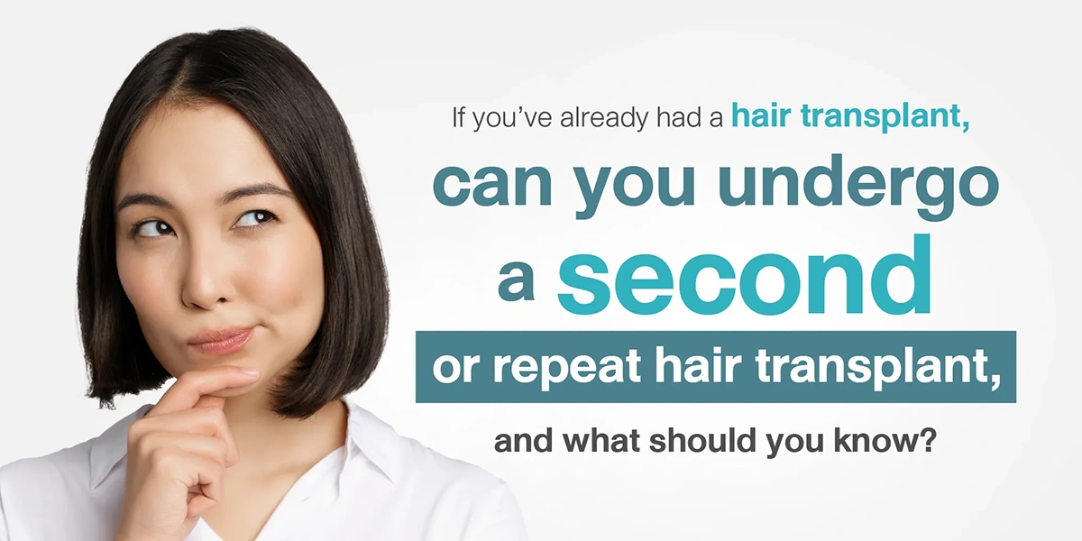 If you’ve already had a hair transplant, can you undergo a second or repeat hair transplant, and what should you know