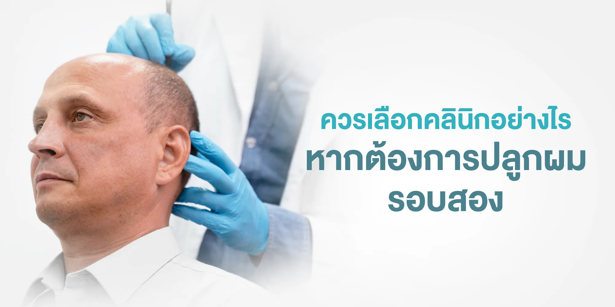 ควรเลือกคลินิกอย่างไร หากต้องการปลูกผมรอบสอง