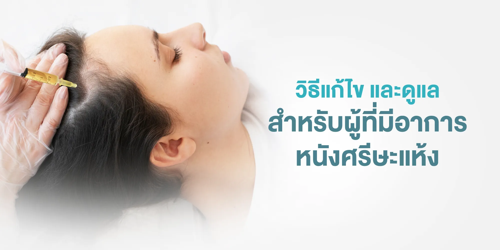 วิธีแก้ไข และดูแลสำหรับผู้ที่มีอาการหนังศรีษะแห้ง
