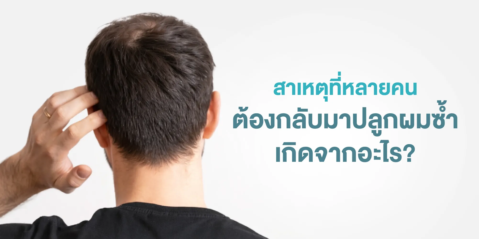 สาเหตุที่หลายคนต้องกลับมาปลูกผมซ้ำ เกิดจากอะไร