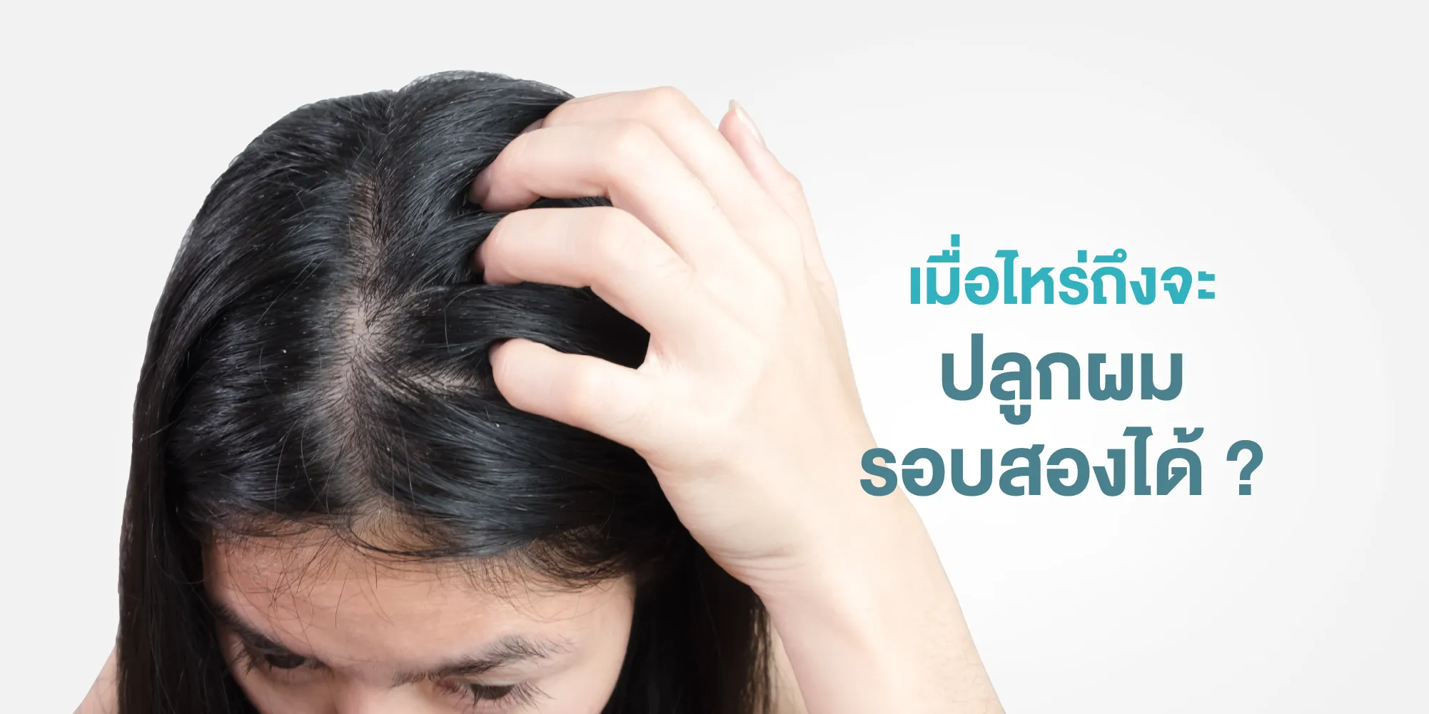 เมื่อไหร่ถึงจะปลูกผมรอบสองได้